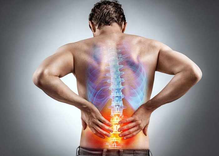 عکس دیسک کمر و علائم دیسک کمر