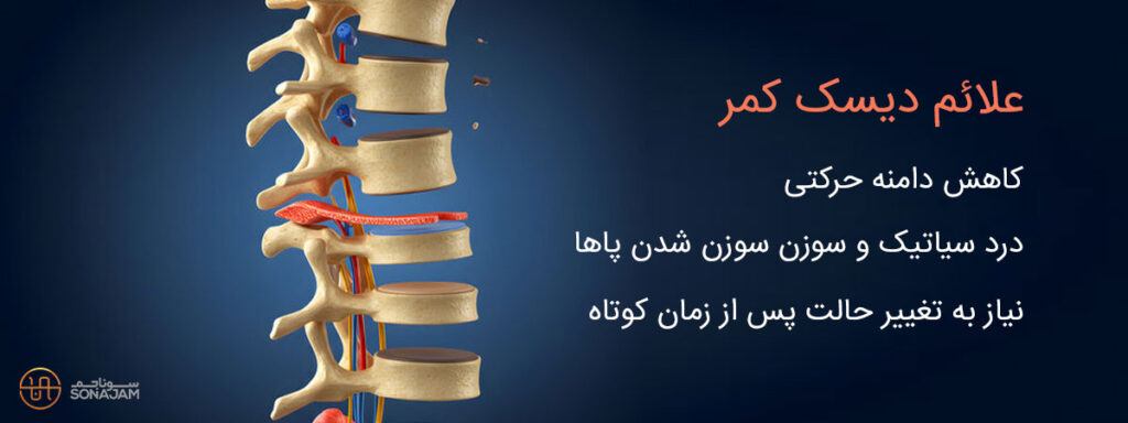 عکس علائم دیسک کمر و نشانه های دیسک کمر حاد